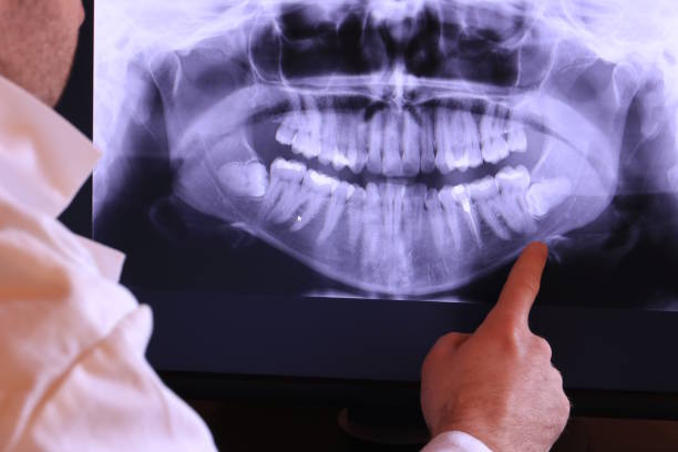Best Emergency Treatment for Dental Infections or Abscesses in Cambridge, IL
